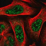 Merck Anti-TBC1D8 antibody produced in rabbit