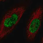 Merck Anti-SREK1 antibody produced in rabbit