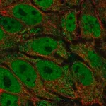 Merck Anti-AKR1E2 antibody produced in rabbit