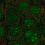 Merck Anti-C10orf67 antibody produced in rabbit