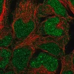 Merck Anti-BCCIP antibody produced in rabbit