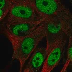Merck Anti-GAL3ST4 antibody produced in rabbit