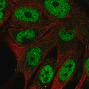 Merck Anti-GAL3ST4 antibody produced in rabbit