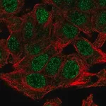Merck Anti-NSMCE4A antibody produced in rabbit