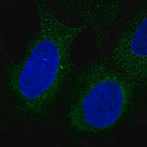 Merck Anti-DIP2B antibody produced in rabbit