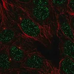 Merck Anti-LMNTD1 antibody produced in rabbit