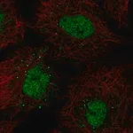 Merck Anti-BARX1 antibody produced in rabbit