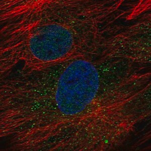Merck Anti-GOLT1B antibody produced in rabbit