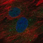 Merck Anti-GOLT1B antibody produced in rabbit