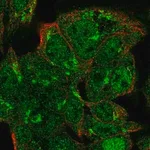 Merck Anti-VPS54 antibody produced in rabbit