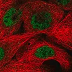 Merck Anti-MED29 antibody produced in rabbit