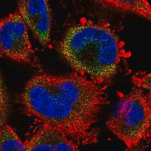 Merck Anti-S100A3 antibody produced in rabbit