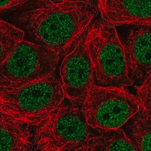 Merck Anti-CHTF18 antibody produced in rabbit