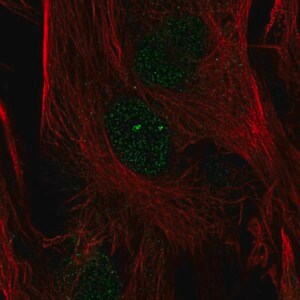 Merck Anti-FOXC2 antibody produced in rabbit