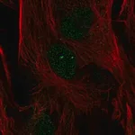 Merck Anti-FOXC2 antibody produced in rabbit