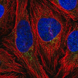 Merck Anti-CLIP4 antibody produced in rabbit