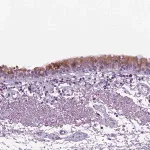 Merck Anti-DNAH11 antibody produced in rabbit