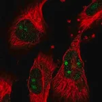 Merck Anti-GTPBP4 antibody produced in rabbit