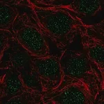 Merck Anti-SRSF5 antibody produced in rabbit