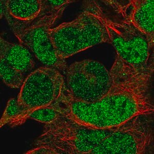 Merck Anti-HOXD10 antibody produced in rabbit