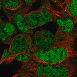 Merck Anti-HOXD10 antibody produced in rabbit