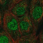 Merck Anti-UBE2A antibody produced in rabbit