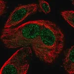 Merck Anti-SNAPC3 antibody produced in rabbit