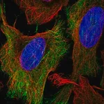 Merck Anti-KCNN1 antibody produced in rabbit