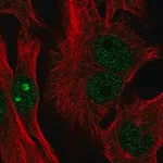 Merck Anti-CTC-534A2.2 antibody produced in rabbit