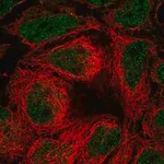 Merck Anti-SLC39A10 antibody produced in rabbit