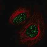 Merck Anti-SRRM2 antibody produced in rabbit