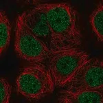 Merck Anti-KAT8 antibody produced in rabbit