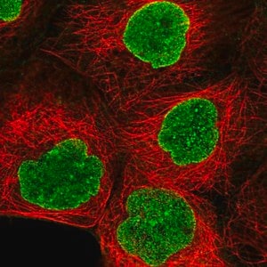 Merck Anti-AMPD3 antibody produced in rabbit