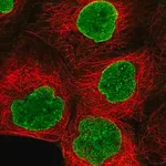 Merck Anti-AMPD3 antibody produced in rabbit