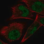 Merck Anti-ELAC1 antibody produced in rabbit