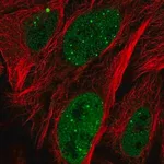 Merck Anti-ZNF32 antibody produced in rabbit
