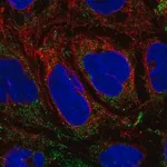 Merck Anti-SLC25A46 antibody produced in rabbit