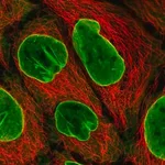 Merck Anti-EIF2B4 antibody produced in rabbit