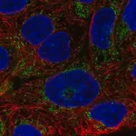 Merck Anti-AIM2 antibody produced in rabbit