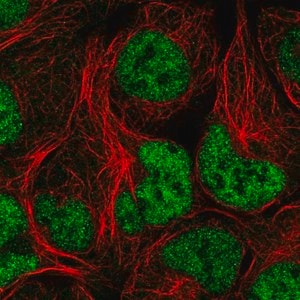 Merck Anti-NCAPD3 antibody produced in rabbit