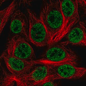 Merck Anti-HOXD1 antibody produced in rabbit
