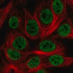 Merck Anti-HOXD1 antibody produced in rabbit