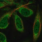Merck Anti-CPEB1 antibody produced in rabbit