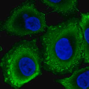 Merck Anti-RPGRIP1L antibody produced in rabbit