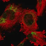 Merck Anti-ANKRD44 antibody produced in rabbit