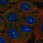 Merck Anti-CACNG6 antibody produced in rabbit