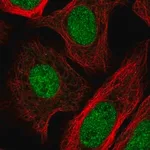 Merck Anti-GTF2IRD2B antibody produced in rabbit