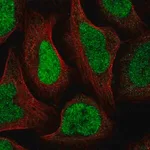 Merck Anti-GTF2IRD2B antibody produced in rabbit