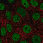 Merck Anti-HNRNPUL2 antibody produced in rabbit