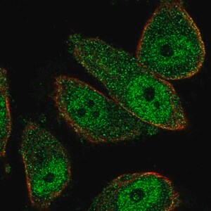 Merck Anti-THSD7B antibody produced in rabbit